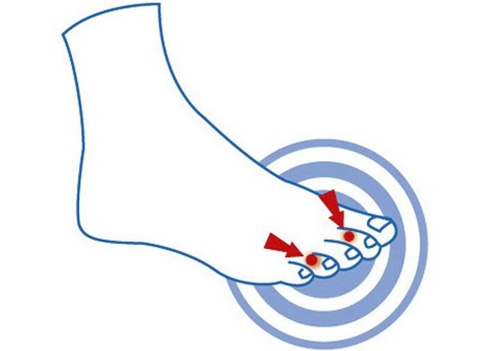 epitact Zehendruckschutzpolster 