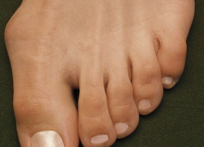 Sandalette von Aerosoft in Weite G–H BLAU