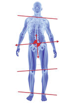 Superthotics Einlagen 
