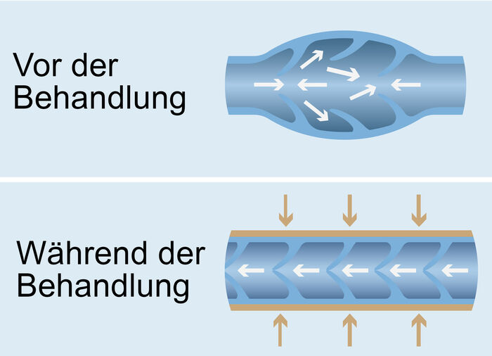 Venen-Massageger&auml;t mit W&auml;rmefunktion 